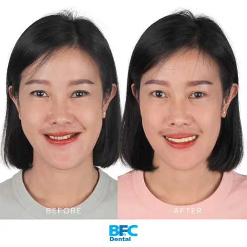 ✅✅BMF-AW03B-05_1