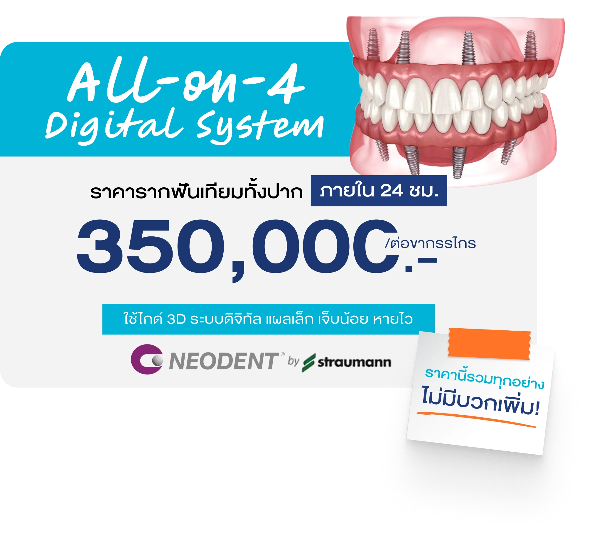 ราคารากฟันเทียมทั้งปาก all on 4 ที่ BFC Dental 350,000 บาทต่อขากรรไกร รวมทุกขั้นตอน